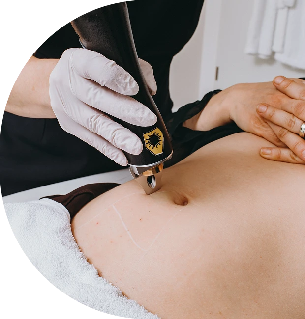 fazfae-brust-und-bauch-hormonell-bedingter-haarwuchs-an-brust-und-bauch