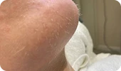 fazfae-dauerhafte-laser-haarentfernung-frauen-haartypen-und-hormone (2)