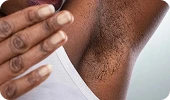 fazfae-dauerhafte-laser-haarentfernung-frauen-haartypen-und-hormone (3)