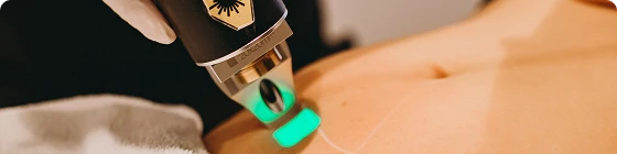 fazfae-dauerhafte-laser-haarentfernung-frauen-modernste-technologie (2)