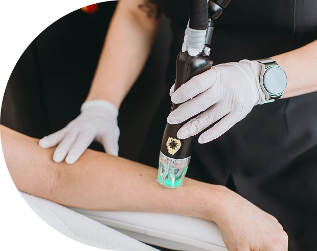 fazfae-dauerhafte-laser-haarentfernung-frauen-wie-funktioniert-die-laser-haarentfernung-im-detail