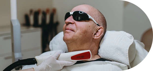fazfae-dauerhafte-laser-haarentfernung-maenner-kontraindikationen