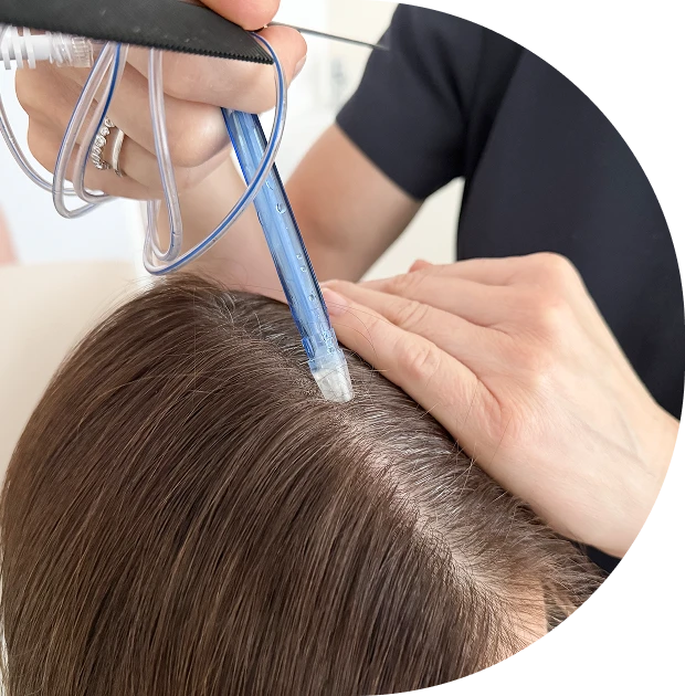 fazfae-kopfhautbehandlung-was-ist-ein-headspa-und-was-ist-ein-hair-spa
